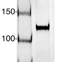 AGO1-PAZ | Argonaute 1 PAZ domain (Chlamydomonas) in the group Antibodies Plant/Algal  / DNA/RNA/Cell Cycle / plant RNA at Agrisera AB (Antibodies for research) (AS14 2797)